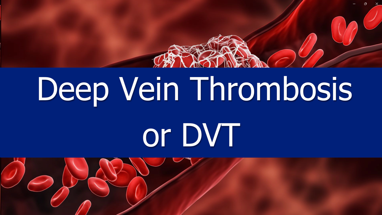 Thrombosis Canada