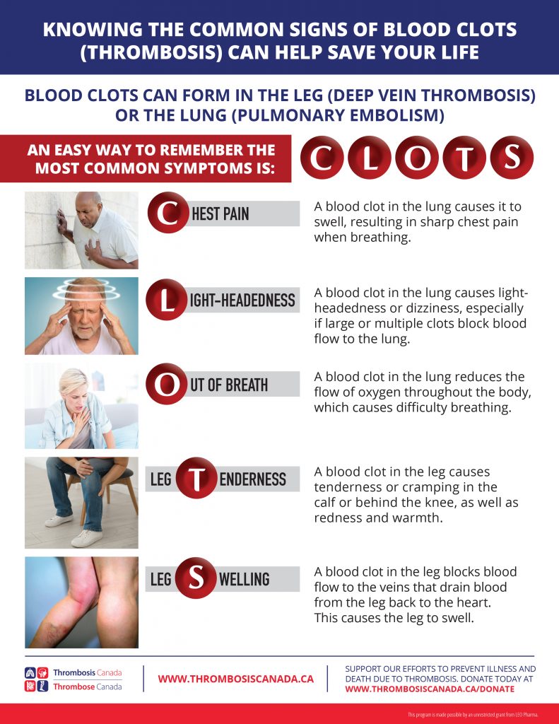 C L O T S Thrombosis Canada Thrombose Canada